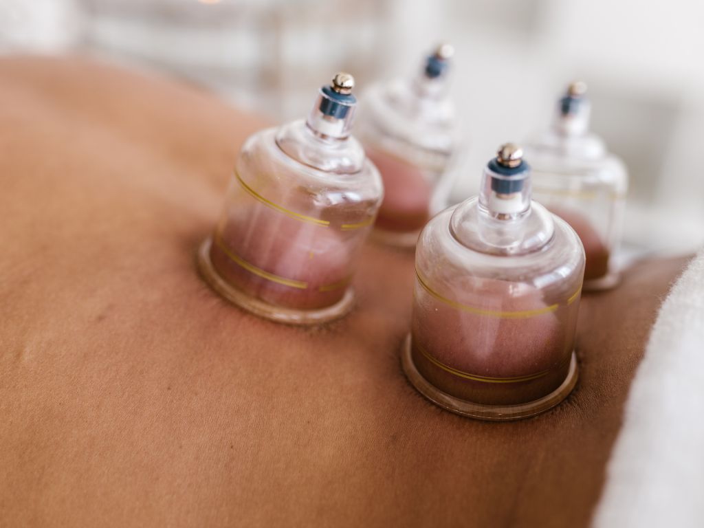 Advanced Cupping Therapy
